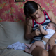 Angelica Pereira feeds her baby Luiza, who was born with microcephaly in Brazil on 6-February 2016. (AP Photo/Felipe Dana)